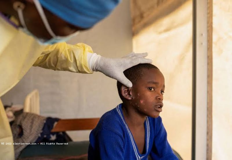 Haut-Uélé : la présence de l'épidémie de Mpox déclarée officiellement par le gouverneur