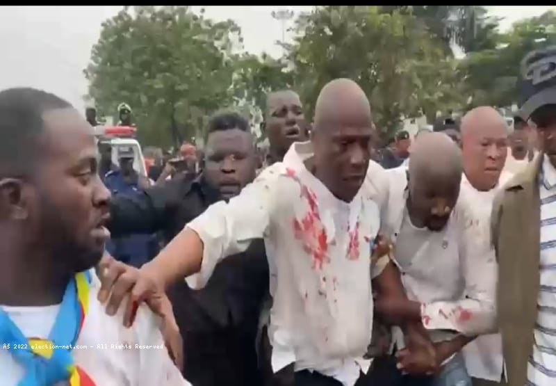Répression du sit-in de l'opposition à Kinshasa : deux morts enregistrés
