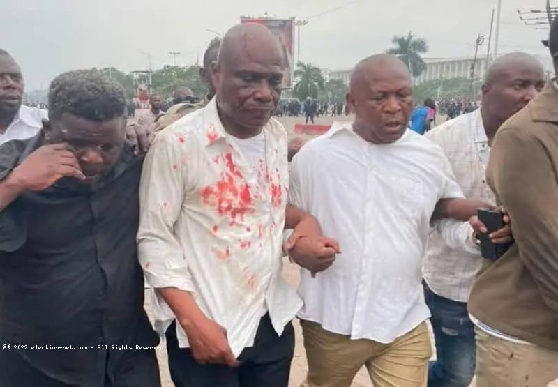 RDC/mobilisation contre le changement de la constitution : 4 opposants blessés par balles